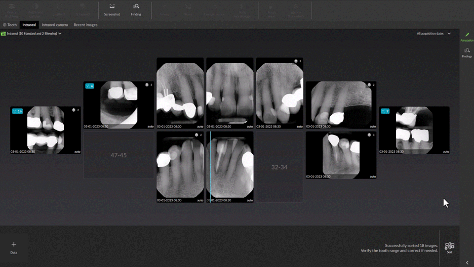 2D-AI-dental-findings-2
