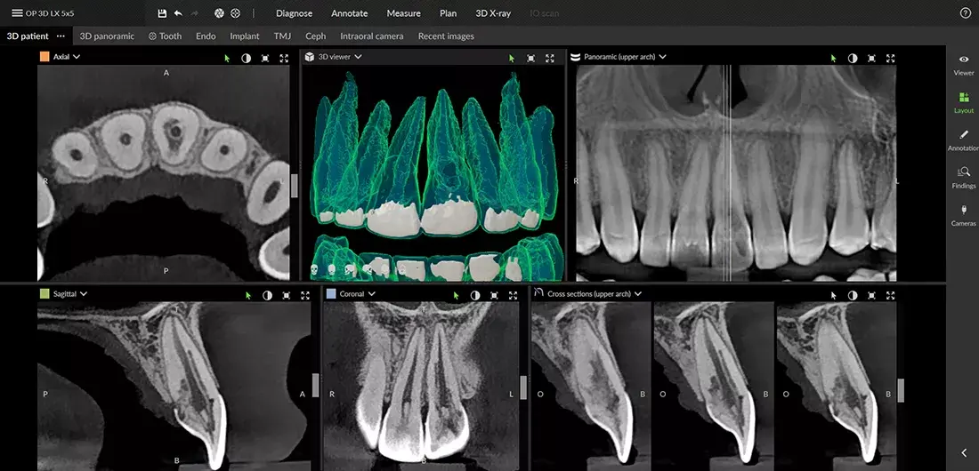 Endodontics.png