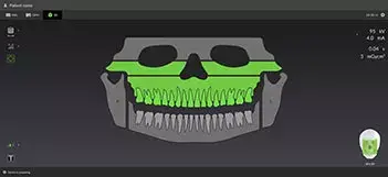 OP-3D-LX-GUI-no-ICE.jpg OP-3D-LX-GUI-no-ICE.jpg